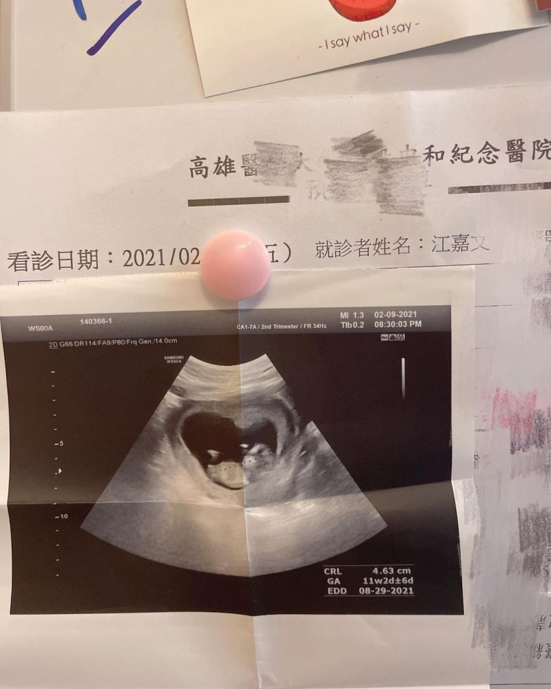 網紅罔腰「沒卵沒子宮」貼超音波照宣布懷孕　婦科醫師發聲：祝福，但不要鬼扯