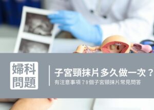 子宮頸抹片多久要做一次？子宮頸抹片常見問答