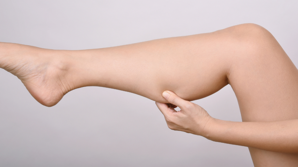 過大的小腿肌是女性常見的煩惱之一。（圖片來源：canva）