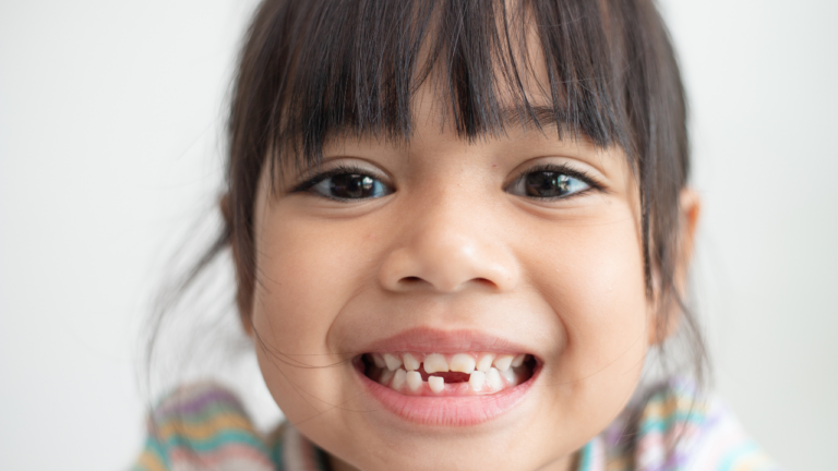 嬰幼童在換牙時，會出現不少口腔問題需要注意。圖片來源／canva