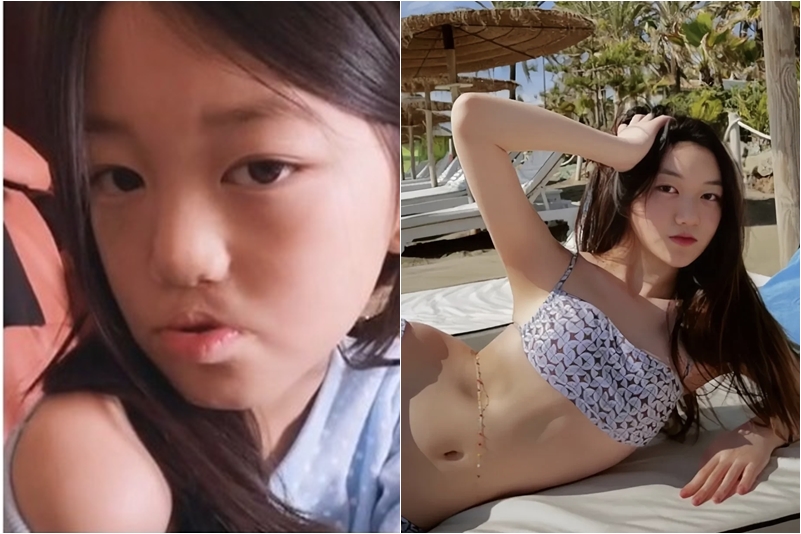 李嫣天生患有唇顎裂，透過手術不斷改善。（圖片來源：小紅書）