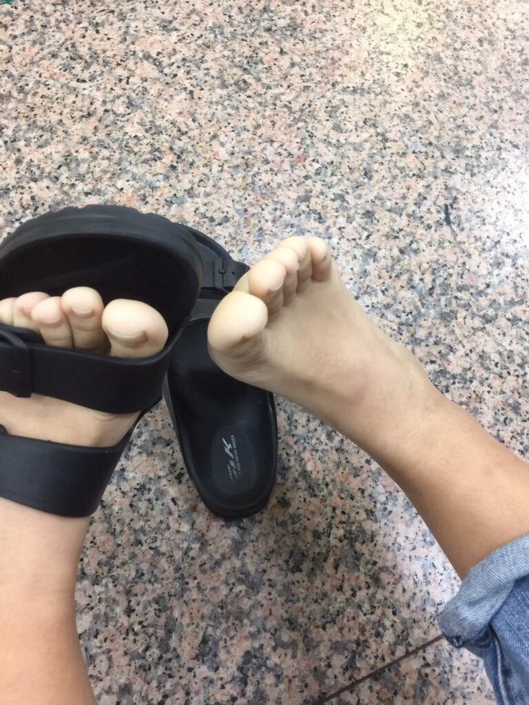 楊月娥女兒小蓁罹患白血病後，出現四肢發白症狀。（圖片來源：臉書 楊月娥）
