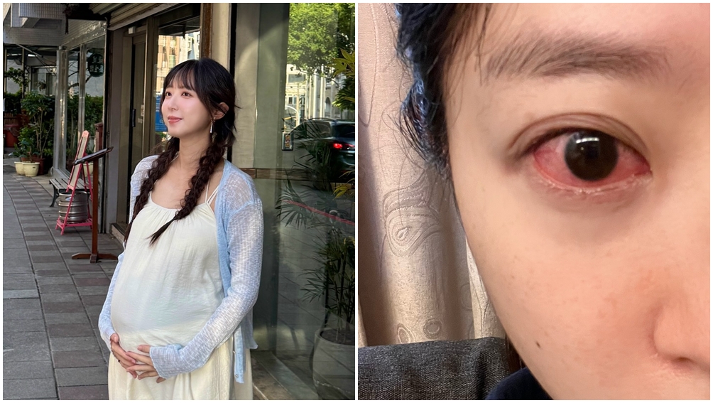 洪詩因為坐月子期間追劇大哭，出現角膜糜爛症狀。（圖片來源：臉書 洪詩）