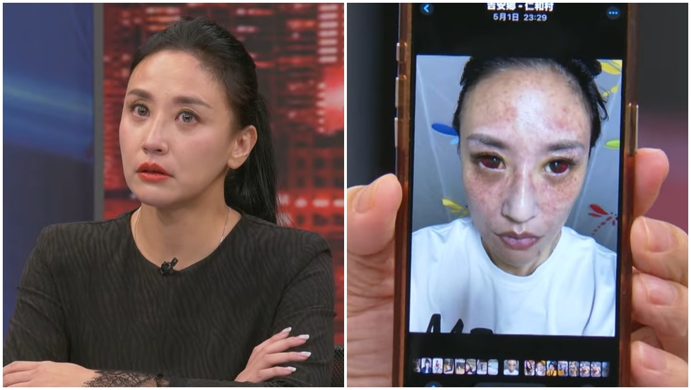 安歆澐控訴遭丈夫家暴。（圖片來源：YouTube 新聞挖挖哇！）