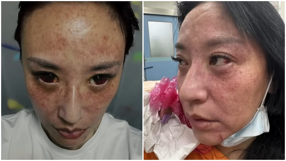 安歆澐遭到家暴，險些喪命。（圖片來源：YouTube 哏傳媒）