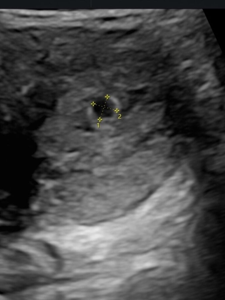 可青曬出超音波照。(圖片來源:臉書 可青)