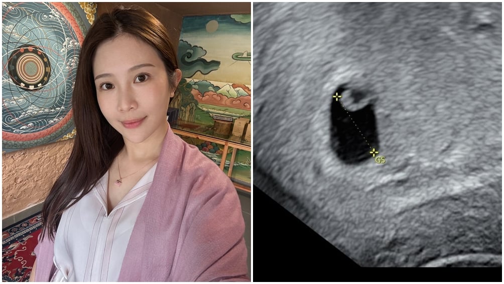 鄭家純懷孕9週，產檢確認胚胎已停止發育。（圖片來源：臉書 鄭家純）