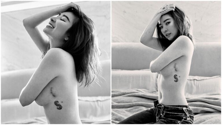 許維恩秀出手術傷疤。（圖片來源：臉書 許維恩）