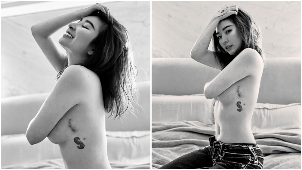 許維恩秀出手術傷疤。（圖片來源：臉書 許維恩）