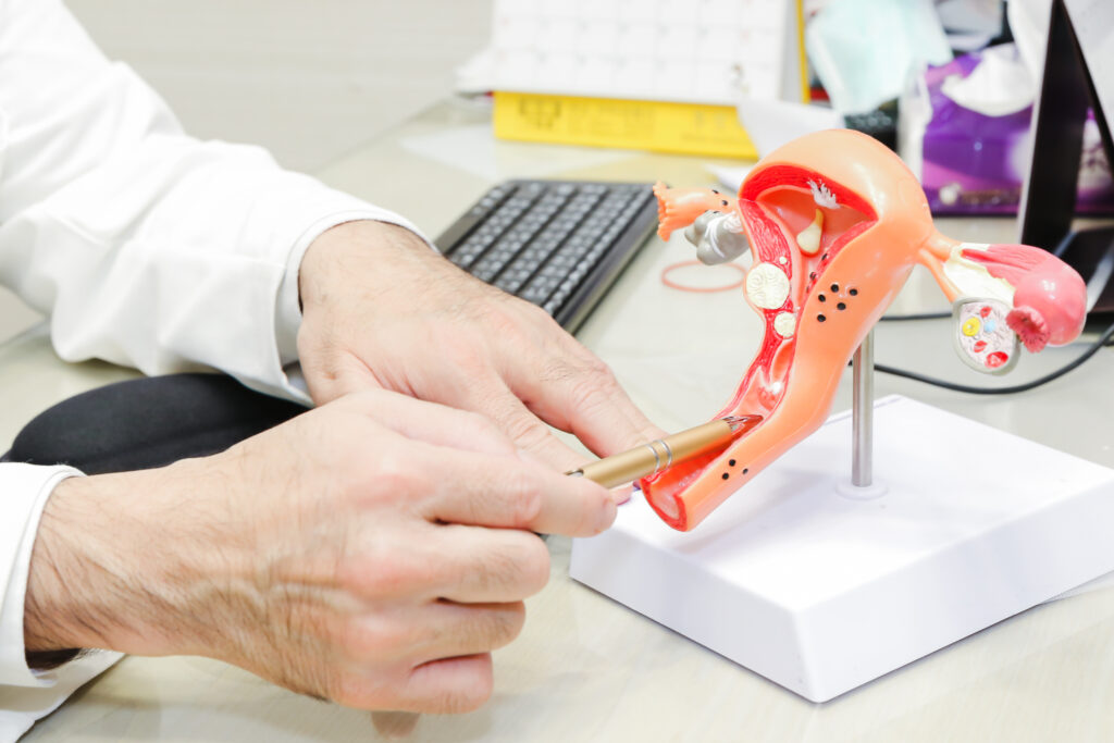 圖片來源：華育生殖醫學婦產科診所