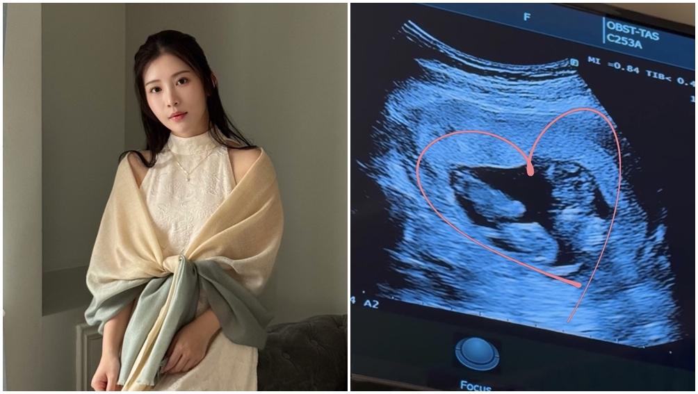 鄭家純懷上雙胞胎。（圖片來源：FB 鄭家純）