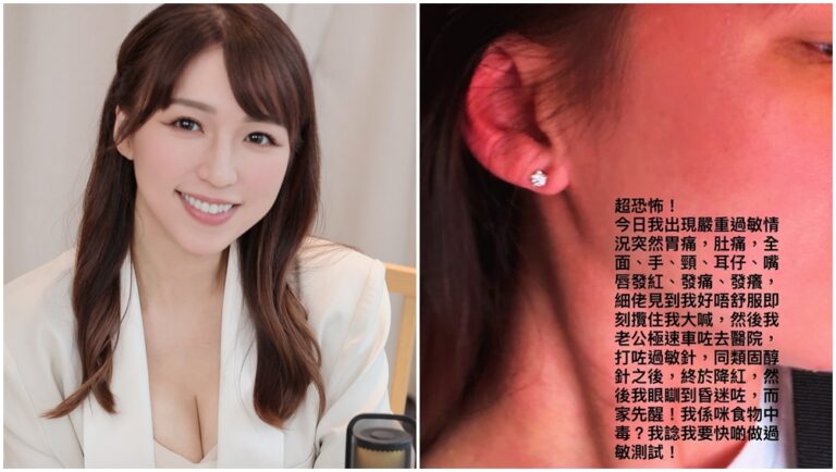 孫慧雪突然爆發嚴重的過敏反應。（圖片來源：Threads snow711）