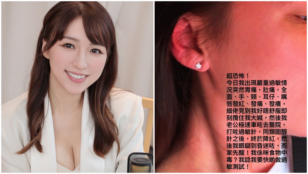 孫慧雪突然爆發嚴重的過敏反應。（圖片來源：Threads snow711）